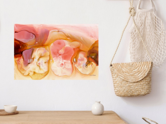 This abstract mixed media piece presents a mesmerizing fusion of soft, translucent layers that flow seamlessly into one another. The gentle transitions of rose, amber, and cream create an inviting atmosphere, offering both depth and a sense of gentle movement. The organic forms and subtle contrasts in color suggest an exploration of light, fluidity, and the natural interplay of elements, resulting in a harmonious and captivating visual experience. Lumina is a celebration of delicate textures and hues, perfect for evoking calm and inspiration.
